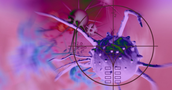 腫瘤低分易中sci