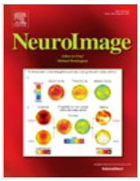 NEUROIMAGEڿ